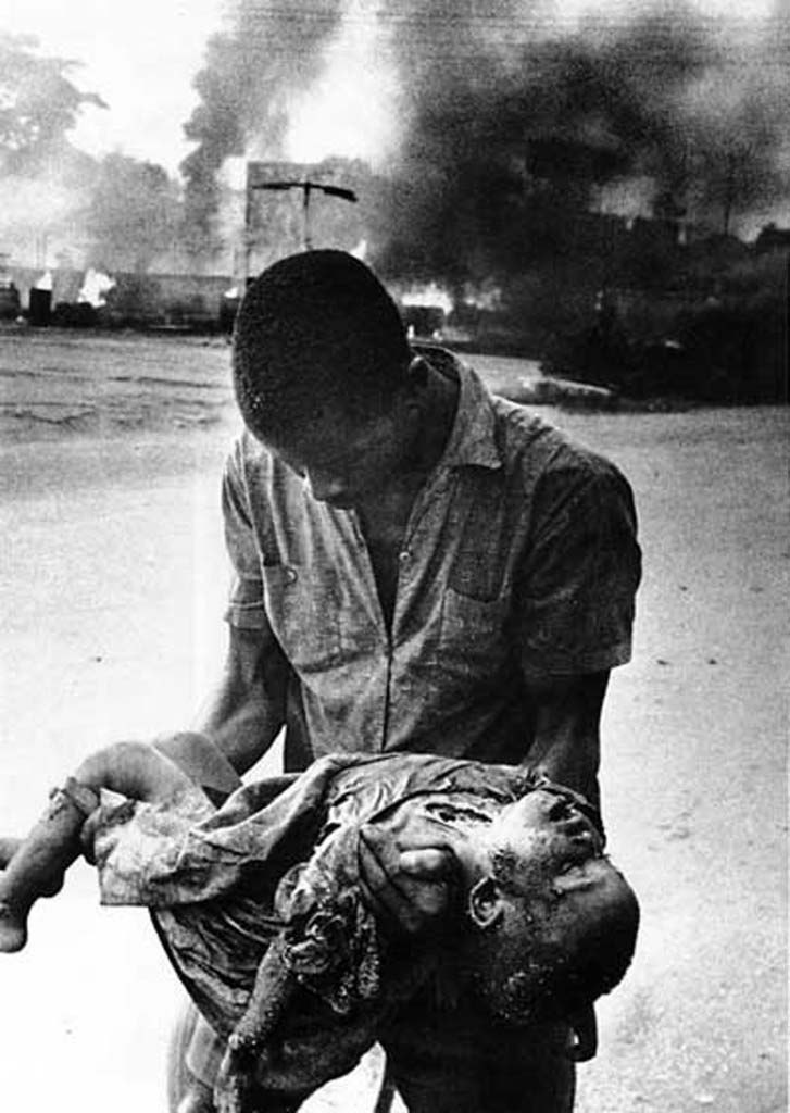 Biafran Casualty in the Nigerian Civil War